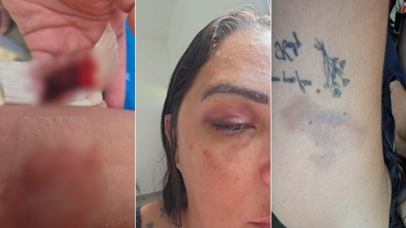 Prefeitura abre investigação após agressões contra paciente com endometriose