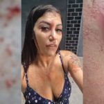 Mãe tem peito rasgado por caco de vidro após defender filhos em briga escolar