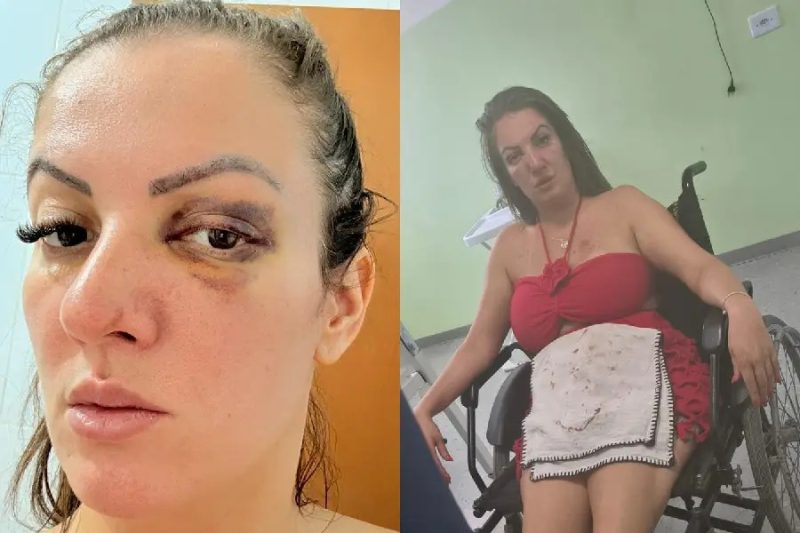 Vereadora Aline Santos atropela namorado após ser agredida