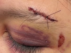 Estudante agredida por causa de ventilador