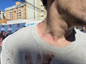 Furto Gonzaga Santos Corrente Pescoço