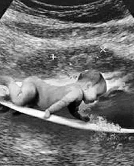 Após anunciar o nascimento de um filho, Medina diz que se refere a ''um projeto''