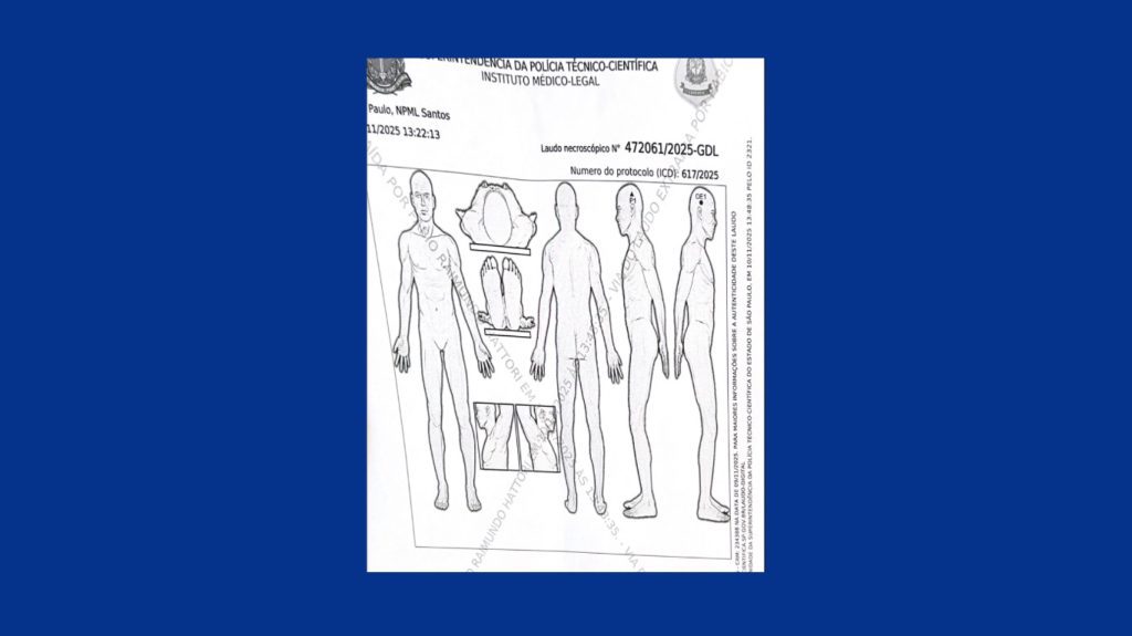 Jovem foi encontrado morto com tiro do lado direito da cabeça, ilustra laudo do IML