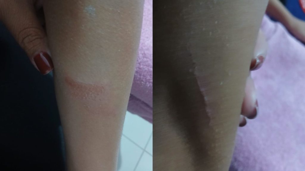 Aluno de 12 anos é espancado em 'corredor polonês' feito por colegas em escola de Santos