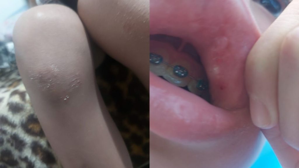 Aluno de 12 anos é espancado em 'corredor polonês' feito por colegas em escola de Santos