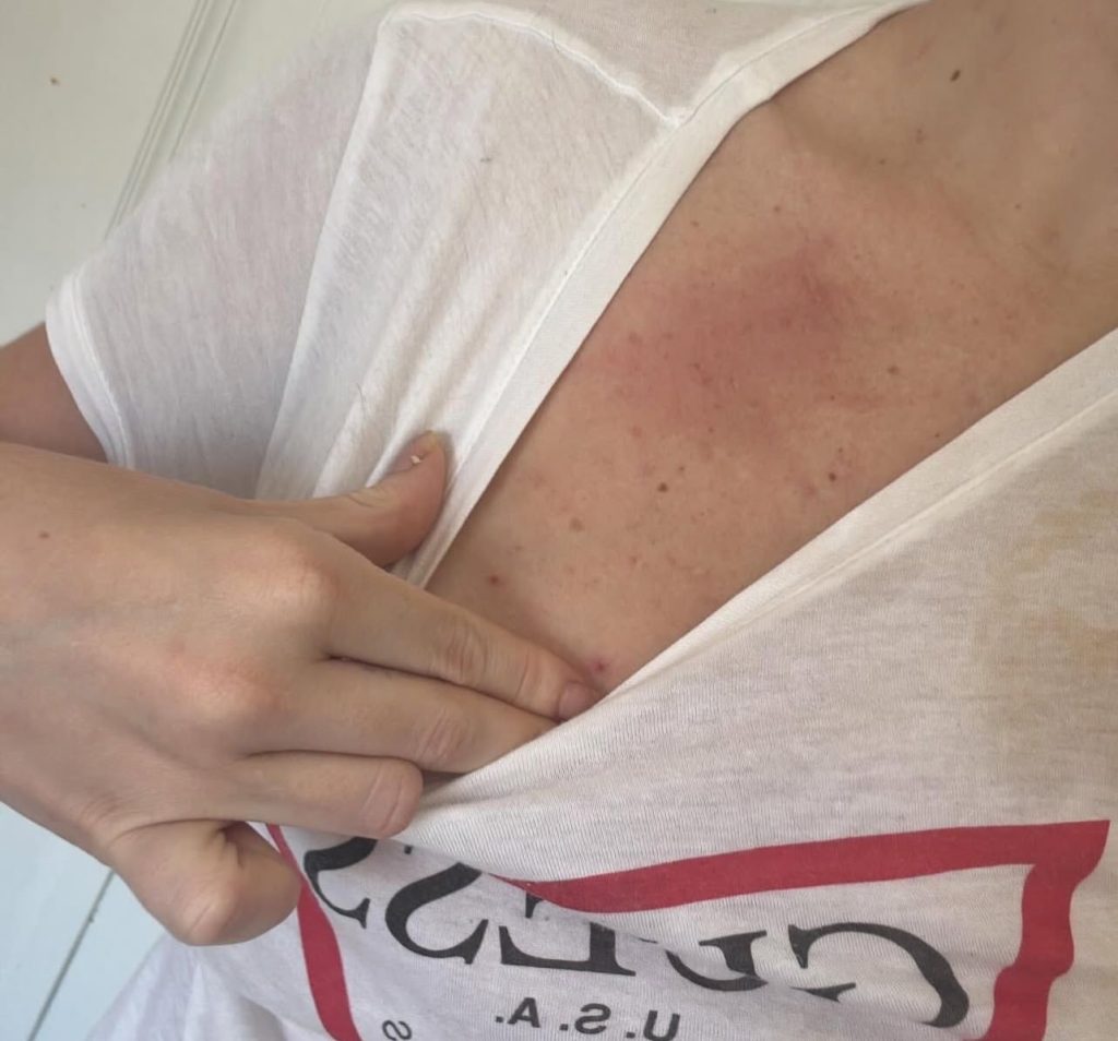 Marcela Tomaszewisk volta a falar sobre as agressões sofridas por Dado Dolabella