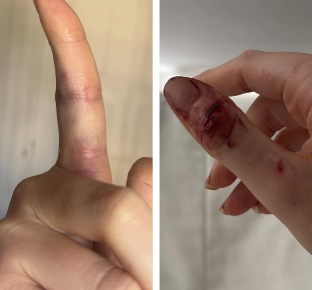 Marcela Tomaszewisk volta a falar sobre as agressões sofridas por Dado Dolabella