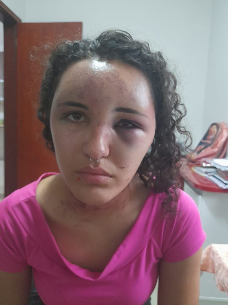 Jovem é atacada e finge estar morta para escapar de tentativa de estupro em Hortolândia