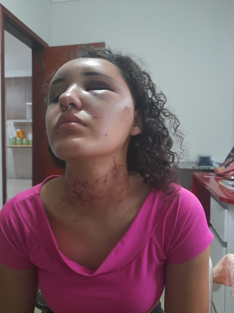 Jovem é atacada e finge estar morta para escapar de tentativa de estupro em Hortolândia