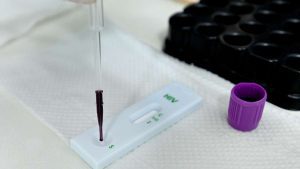 Teste rápido para HIV com aplicação de amostra de sangue
