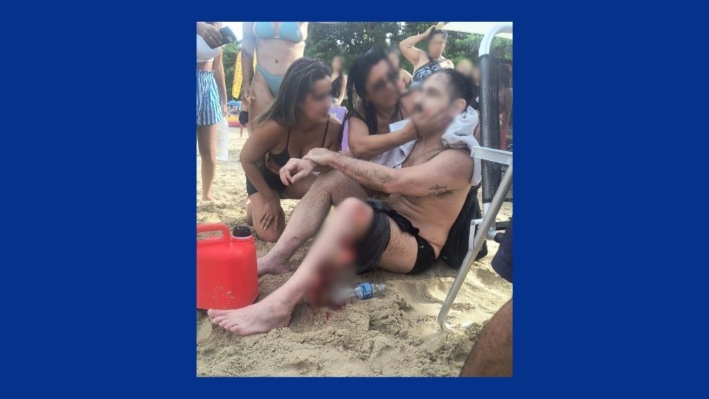 Homem é atingido por hélice de lancha e tem perna rasgada em Ubatuba