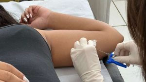 Implanon está disponível de forma gratuita na rede municipal de saúde de Americana