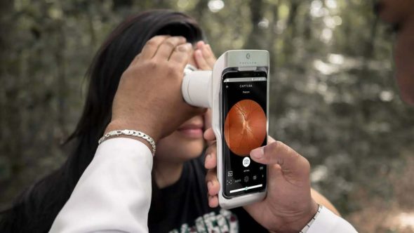 exames de retina com IA em Campinas
