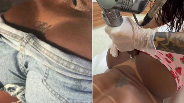 gracyanne-barbosa-apaga-tatuagem-de-Belo-3