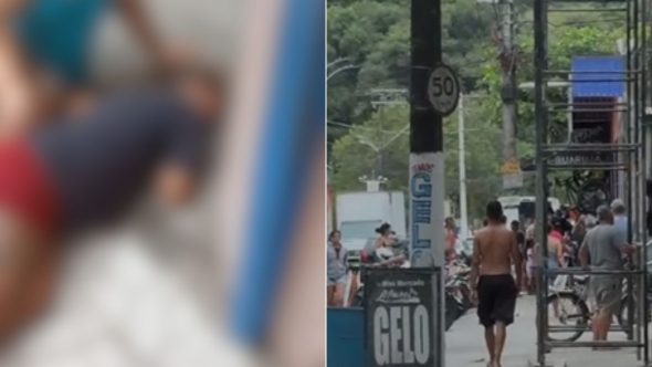 mulher-baleada-cabeça-guarujá